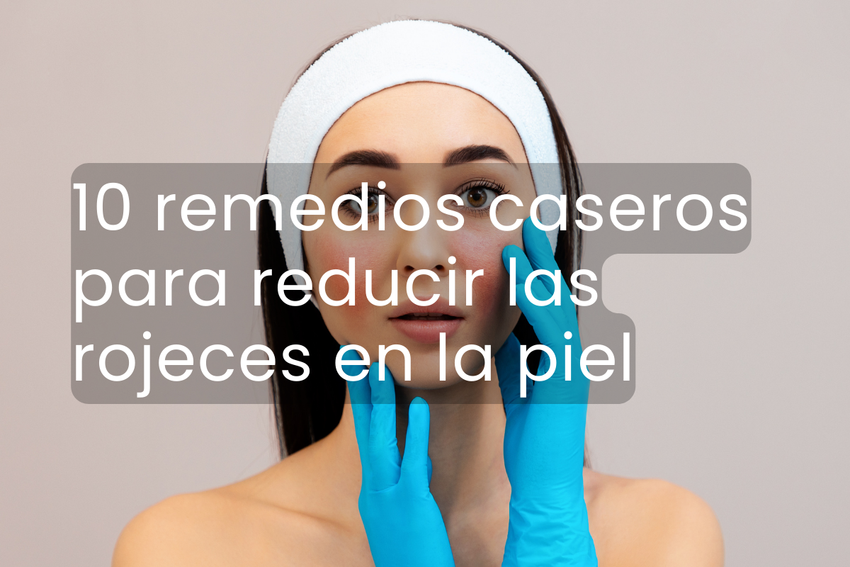 Mujer con problemas de rosacea tocando su rostro con guantes