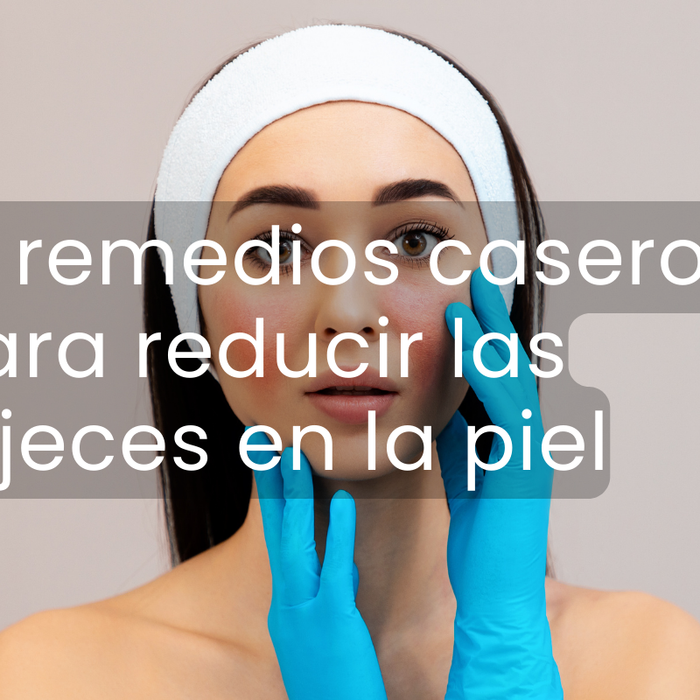 Mujer con problemas de rosacea tocando su rostro con guantes